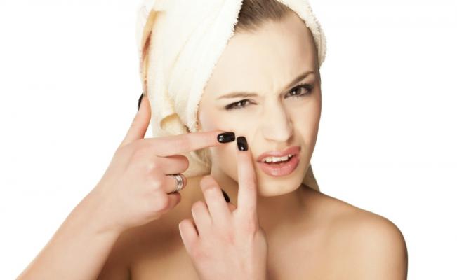 Como tratar corretamente a acne que aparece no dia da festa
